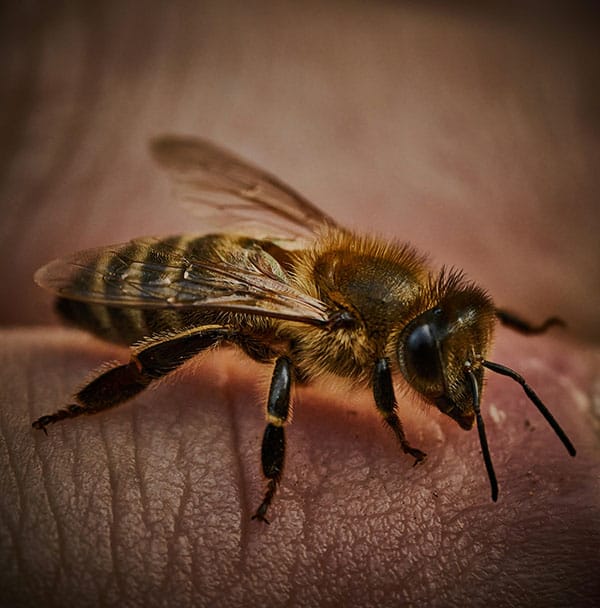 Honigbiene auf der Haut. Kurz vor dem Stich Was hilft gegen Bienenstich? Honigbiene auf der Haut – kurz vor dem Stich